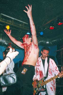 HAEMORRHAGE