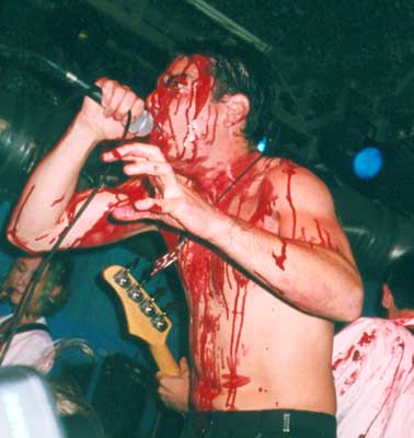 HAEMORRHAGE